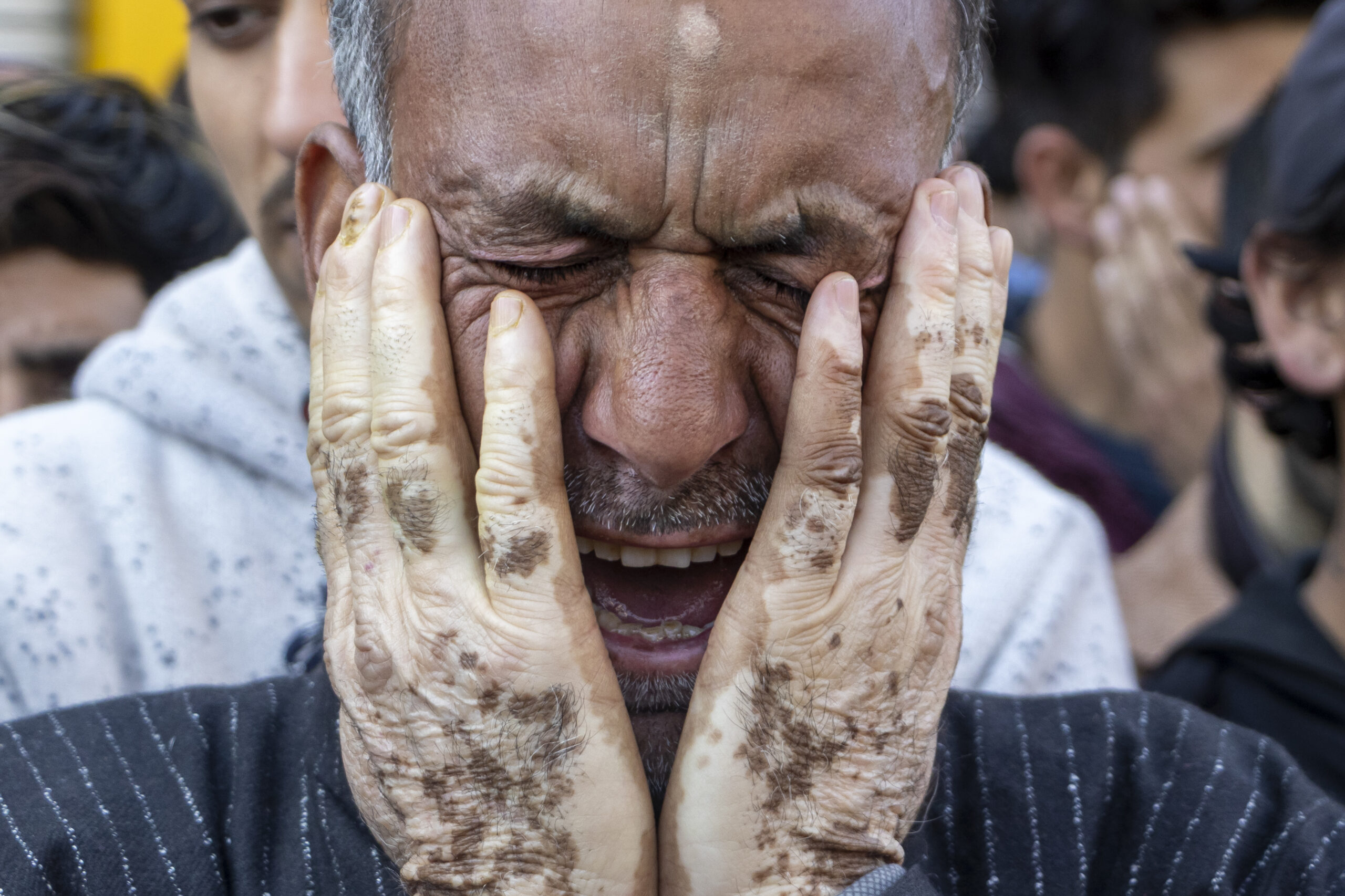 Anxietatea provocată de război: cum îți poți proteja sănătatea mintală în perioade de criză