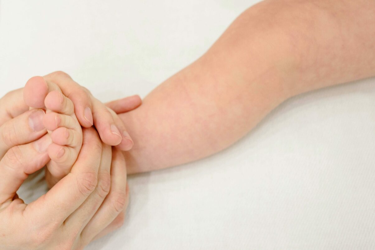 Pacienții cu dermatită atopică: efecte severe după tratamentul îndelungat cu corticosteroizi