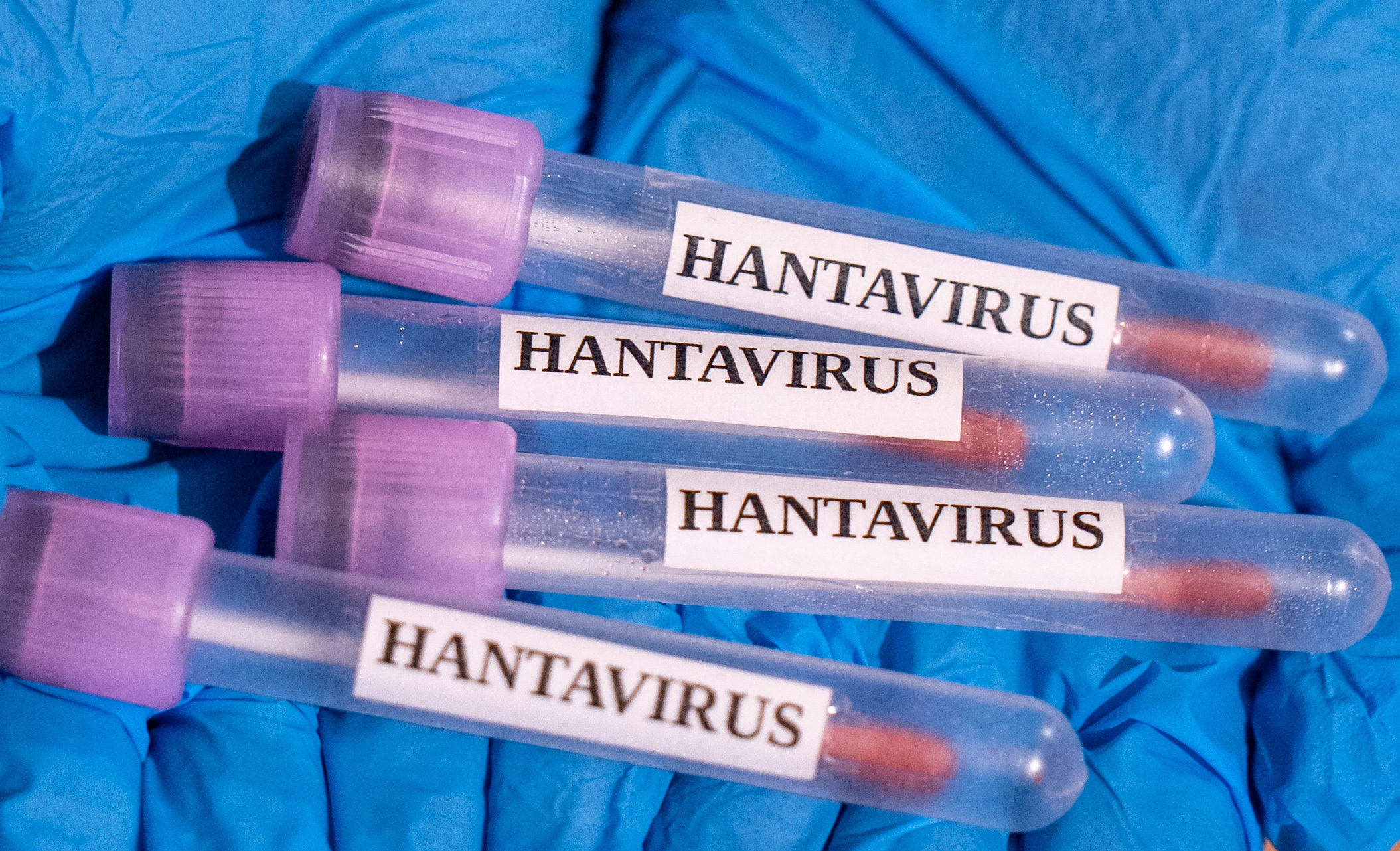 Un american de pe nava MV Hondius, depistat „ușor pozitiv” la testul PCR pentru tulpina Andes a hantavirusului